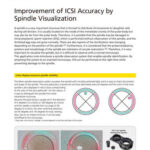 Improvement of ICSI Accuracy by Spindle Visualization