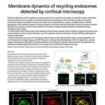 Membrane dynamics of recycling endosomes detected by confocal microscopy