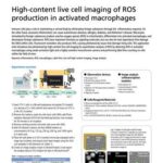 High-content live cell imaging of ROS production in activated macrophages
