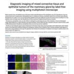 Diagnostic imaging of mixed connective tissue and epithelial tumors of the mammary gland by label-free imaging using multiphoton microscope