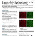 Chụp ảnh tua thời gian có kích thích ánh sáng của tế bào HeLa sống bằng kính confocal