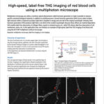 Chụp ảnh THG tốc độ cao, không nhuộm của hồng cầu bằng kính hiển vi đa photon