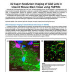 Chụp ảnh siêu phân giải 3D tế bào thần kinh đệm trong mô não chuột đã làm trong bằng NSPARC