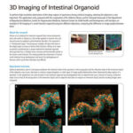 3D Imaging of Intestinal Organoid