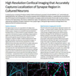 High Resolution Confocal Imaging that Accurately Captures Localization of Synapse Region in Cultured Neurons