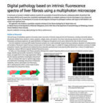 Digital pathology based on intrinsic fluorescence spectra of liver fibrosis using a multiphoton microscope