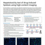 Hepatotoxicity test of drug-induced lipidosis using high-content imaging